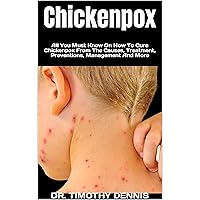 Chickenpox : All You Must Know On How To Cure Chickenpox From The Causes, Treatment, Preventions, Management And More Chickenpox : All You Must Know On How To Cure Chickenpox From The Causes, Treatment, Preventions, Management And More Kindle