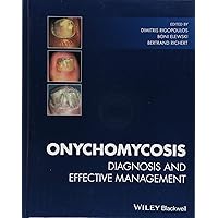 Onychomycosis: Diagnosis and Effective Management Onychomycosis: Diagnosis and Effective Management Hardcover Kindle