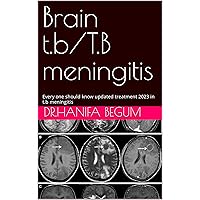 Brain t.b/T.B meningitis : Every one should know updated treatment 2023 in t.b meningitis