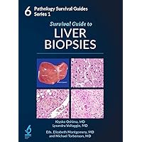 Survival Guide to Liver Biopsies