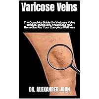 Varicose Veins : The Complete Guide On Varicose Veins Causes, Symptom, Treatment And Remedies For Your Complete Wellness Varicose Veins : The Complete Guide On Varicose Veins Causes, Symptom, Treatment And Remedies For Your Complete Wellness Kindle Paperback
