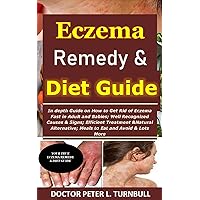Eczema Remedy & Diet Guide: In depth Guide on How to Get Rid of Eczema Fast in Adult and Babies;Well Recognized Causes & Signs;Efficient Treatment &Natural ... to Eat and Avoid&Lots More Eczema Remedy & Diet Guide: In depth Guide on How to Get Rid of Eczema Fast in Adult and Babies;Well Recognized Causes & Signs;Efficient Treatment &Natural ... to Eat and Avoid&Lots More Kindle Paperback