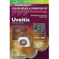 Uveitis (Color Atlas and Synopsis of Clinical Ophthalmology) Uveitis (Color Atlas and Synopsis of Clinical Ophthalmology) Paperback Kindle