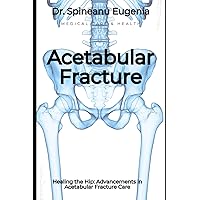 Healing the Hip: Advancements in Acetabular Fracture Care (Medical care and health)