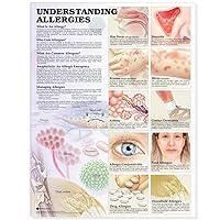ACC Understanding Allergies Anatomical Chart