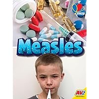Measles (International Outbreaks) Measles (International Outbreaks) Library Binding Paperback