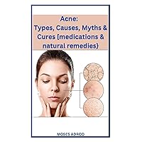 Acne: Types, Causes, Myths & Cures [medications & natural remedies}. Acne: Types, Causes, Myths & Cures [medications & natural remedies}. Kindle Paperback