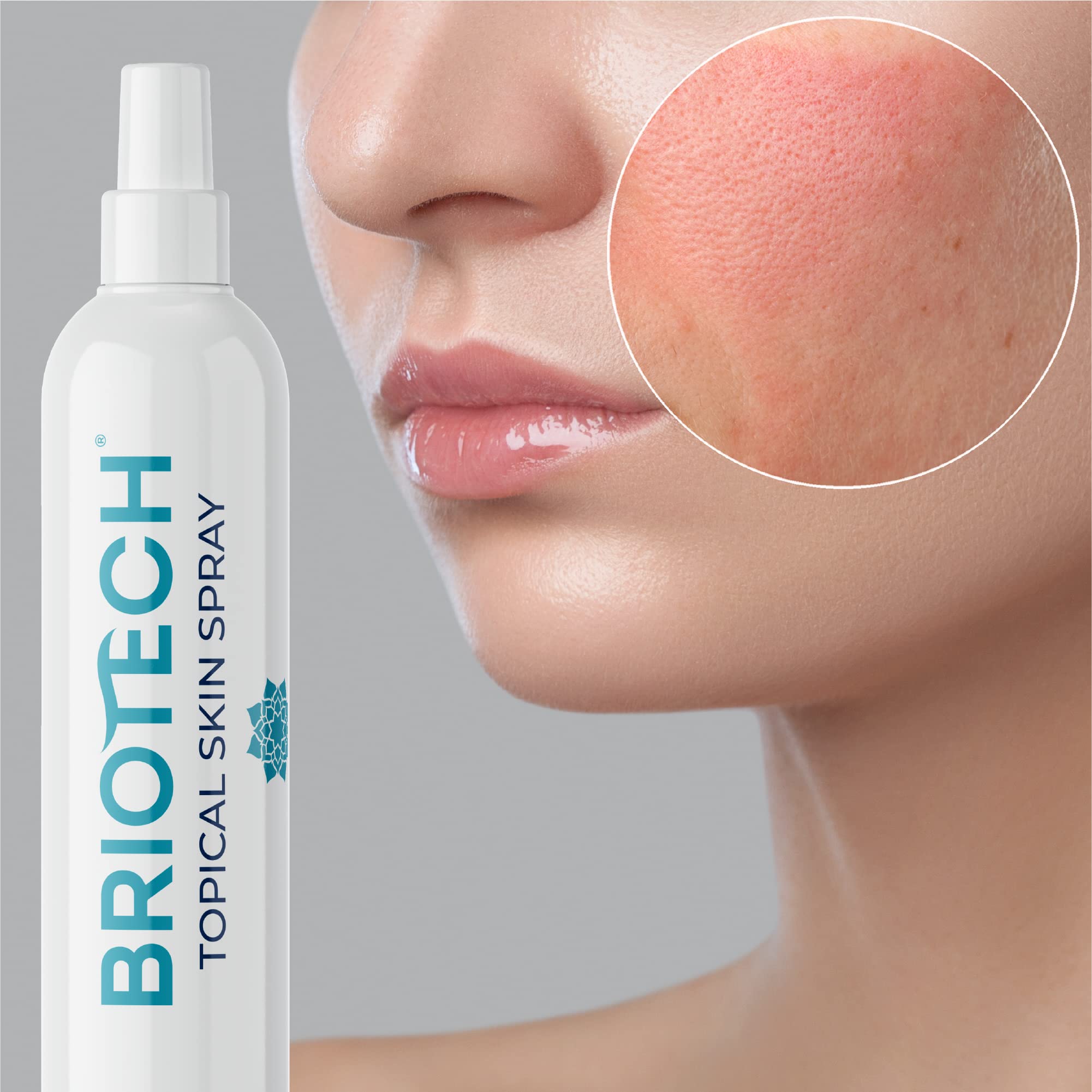 BRIOTECH Topical Skin Spray, Pure Hypochlorous Acid Spray, Face & Body HOCl Mist, Support Irritations, Soothe Redness, Eyelid Eyelash Bumps, Dry Skin & Scalp, Athletic Itch, Toenail Cleanser