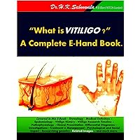 “What is VITILIGO?’’ A Complete E- Hand Book. “What is VITILIGO?’’ A Complete E- Hand Book. Kindle