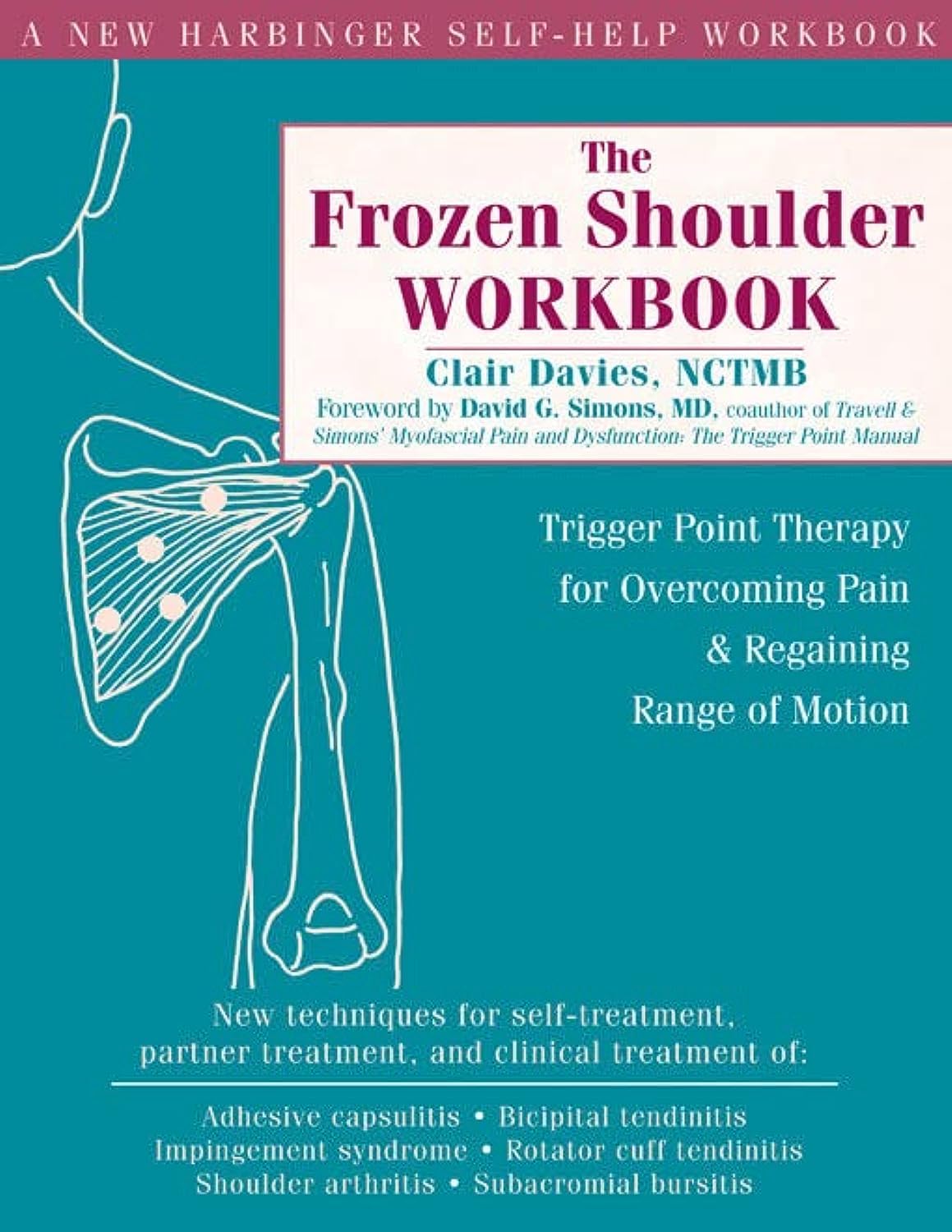The Frozen Shoulder Workbook: Trigger Point Therapy for Overcoming Pain and Regaining Range of Motion (A New Harbinger Self-Help Workbook)