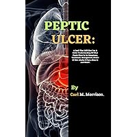 PEPTIC ULCER: A Book That Will Give You A Better Understanding Of What Peptic Ulcer Is, Its Symptoms, Treatment, Management, Choice Of Diet ,Myths & Facts About It And More!. PEPTIC ULCER: A Book That Will Give You A Better Understanding Of What Peptic Ulcer Is, Its Symptoms, Treatment, Management, Choice Of Diet ,Myths & Facts About It And More!. Kindle Hardcover Paperback