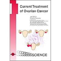 Current Treatment of Ovarian Cancer (UNI-MED Science) Current Treatment of Ovarian Cancer (UNI-MED Science) Kindle