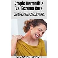 Atopic Dermatitis Vs. Eczema Cure : All You Must Know On How To Cure Atopic Dermatitis Vs. Eczema From The Causes, Treatment, Preventions, Management And More Atopic Dermatitis Vs. Eczema Cure : All You Must Know On How To Cure Atopic Dermatitis Vs. Eczema From The Causes, Treatment, Preventions, Management And More Kindle