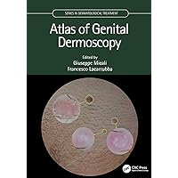 Atlas of Genital Dermoscopy (Series in Dermatological Treatment) Atlas of Genital Dermoscopy (Series in Dermatological Treatment) Kindle Hardcover