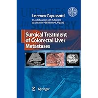 Surgical Treatment of Colorectal Liver Metastases (Updates in Surgery) Surgical Treatment of Colorectal Liver Metastases (Updates in Surgery) Hardcover Paperback