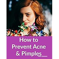 How to Prevent Acne & Pimples How to Prevent Acne & Pimples Kindle