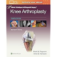 Master Techniques in Orthopedic Surgery: Knee Arthroplasty (Master Techniques in Orthopaedic Surgery) Master Techniques in Orthopedic Surgery: Knee Arthroplasty (Master Techniques in Orthopaedic Surgery) Hardcover Kindle