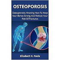 OSTEOPOROSIS: Osteoporosis; Knowing How To Keep Your Bones Strong And Reduce Your Risk Of Fractures OSTEOPOROSIS: Osteoporosis; Knowing How To Keep Your Bones Strong And Reduce Your Risk Of Fractures Kindle Paperback