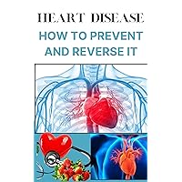Heart Disease: How To Prevent And Reverse It: Treat Arterial Plaque And Prevent Heart Attacks And Strokes, Improve Cardiac Health And Lose Weight, Personal ... To Taking Control Of Your Health, diet Heart Disease: How To Prevent And Reverse It: Treat Arterial Plaque And Prevent Heart Attacks And Strokes, Improve Cardiac Health And Lose Weight, Personal ... To Taking Control Of Your Health, diet Kindle Paperback