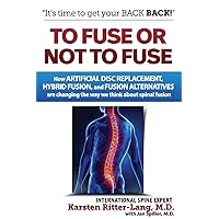 To Fuse or Not to Fuse: How Artificial Disc Replacement, Hybrid Fusion, and Fusion Alternatives are Changing the Way We Think about Spinal Fusion To Fuse or Not to Fuse: How Artificial Disc Replacement, Hybrid Fusion, and Fusion Alternatives are Changing the Way We Think about Spinal Fusion Paperback Kindle