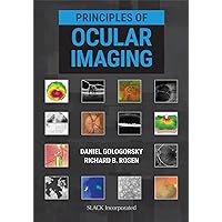 Principles of Ocular Imaging Principles of Ocular Imaging Hardcover Kindle