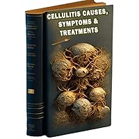 Cellulitis Causes, Symptoms & Treatments: Learn about the causes, symptoms, and treatment options for cellulitis, a skin infection. Cellulitis Causes, Symptoms & Treatments: Learn about the causes, symptoms, and treatment options for cellulitis, a skin infection. Paperback