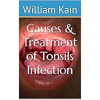 Causes & Treatment of Tonsils Infection Causes & Treatment of Tonsils Infection Kindle Paperback