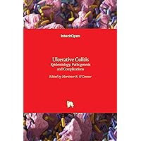 Ulcerative Colitis: Epidemiology, Pathogenesis and Complications
