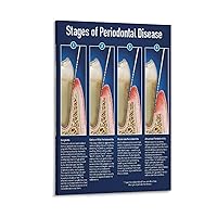 GEBSKI Stages of Periodontal Disease Posters Dental Poster Dentist's Office Poster Canvas Painting Posters And Prints Wall Art Pictures for Living Room Bedroom Decor 08x12inch(20x30cm) Frame-style