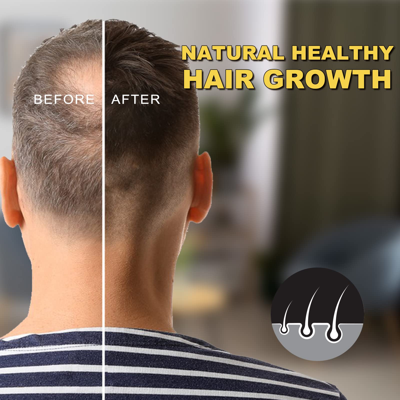 5% Minoxidil for Men and Women Hair Growth Oil, Biotin Hair Growth Serum Hair Regrowth Treatment for Scalp Hair Loss Hair Thinning, Natural Hair Growth for Thicker Longer Fuller Healthier Hair 2.02 oz