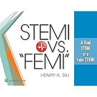 STEMI vs. “FEMI”: A Real STEMI or a Fake STEMI STEMI vs. “FEMI”: A Real STEMI or a Fake STEMI Kindle Paperback