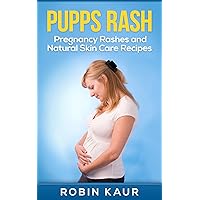 Pupps Rash: Pregnancy Rashes and Natural Skin Care Recipes (Skin Rashes During Pregnancy, Motherhood, Pupps Treatment)