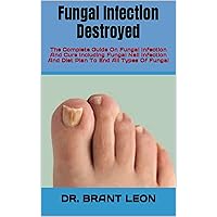 Fungal Infection Destroyed : The Complete Guide On Fungal Infection And Cure Including Fungal Nail Infection And Diet Plan To End All Types Of Fungal Fungal Infection Destroyed : The Complete Guide On Fungal Infection And Cure Including Fungal Nail Infection And Diet Plan To End All Types Of Fungal Kindle Paperback