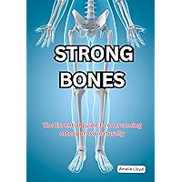STRONG BONES: THE ESSENTIAL GUIDE TO OVERCOMING OSTEOPOROSIS NATURALLY (STRONG BONES SERIES: EMPOWERING AGAINST OSTEOPOROSIS Book 1) STRONG BONES: THE ESSENTIAL GUIDE TO OVERCOMING OSTEOPOROSIS NATURALLY (STRONG BONES SERIES: EMPOWERING AGAINST OSTEOPOROSIS Book 1) Kindle Paperback