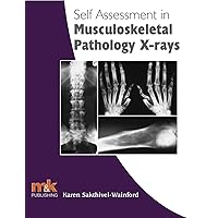 Self Assessment in Musculoskeletal Pathology X-rays (Self-assessment in X-ray Interpretation Book 4) Self Assessment in Musculoskeletal Pathology X-rays (Self-assessment in X-ray Interpretation Book 4) Kindle