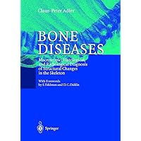 Bone Diseases: Macroscopic, Histological, and Radiological Diagnosis of Structural Changes in the Skeleton Bone Diseases: Macroscopic, Histological, and Radiological Diagnosis of Structural Changes in the Skeleton Hardcover