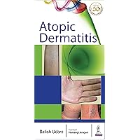 Atopic Dermatitis Atopic Dermatitis Kindle Paperback