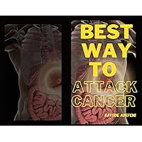 BEST WAY TO ATTACK CANCER: HOW TO FIGHT CANCER BEST WAY TO ATTACK CANCER: HOW TO FIGHT CANCER Kindle Paperback