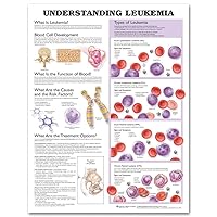 Understanding Leukemia Anatomical Chart