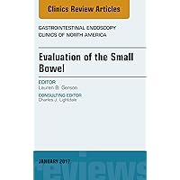 Evaluation of the Small Bowel, An Issue of Gastrointestinal Endoscopy Clinics (The Clinics: Internal Medicine Book 27) Evaluation of the Small Bowel, An Issue of Gastrointestinal Endoscopy Clinics (The Clinics: Internal Medicine Book 27) Kindle Hardcover