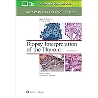 Biopsy Interpretation of the Thyroid (Biopsy Interpretation Series) Biopsy Interpretation of the Thyroid (Biopsy Interpretation Series) Hardcover Kindle