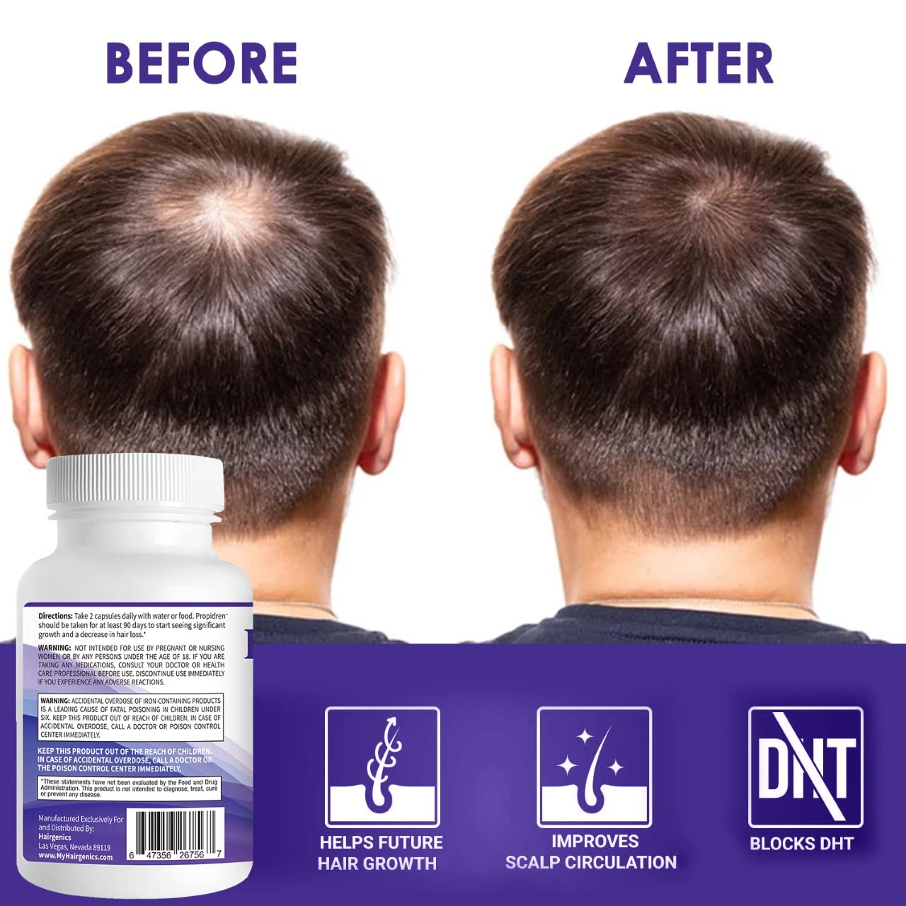 Mua Propidren by HairGenics - DHT Blocker with Saw Palmetto To Prevent Hair  Loss and Stimulate Hair Follicles to Stop Hair Loss and Regrow Hair. trên  Amazon Mỹ chính hãng 2023 | Fado