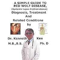 A Simple Guide To Red Wolf Disease (Systemic Lupus Erythematosus), Diagnosis, Treatment And Related Conditions A Simple Guide To Red Wolf Disease (Systemic Lupus Erythematosus), Diagnosis, Treatment And Related Conditions Kindle