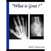 What is Gout? The Ultimate Guide To Mastering and Conquering Gout. Know the Symptoms of Gout, Causes of Gout, Treatment for Gout and more. What is Gout? The Ultimate Guide To Mastering and Conquering Gout. Know the Symptoms of Gout, Causes of Gout, Treatment for Gout and more. Kindle Paperback