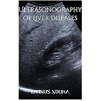 Ultrasonography of liver diseases Ultrasonography of liver diseases Kindle Paperback