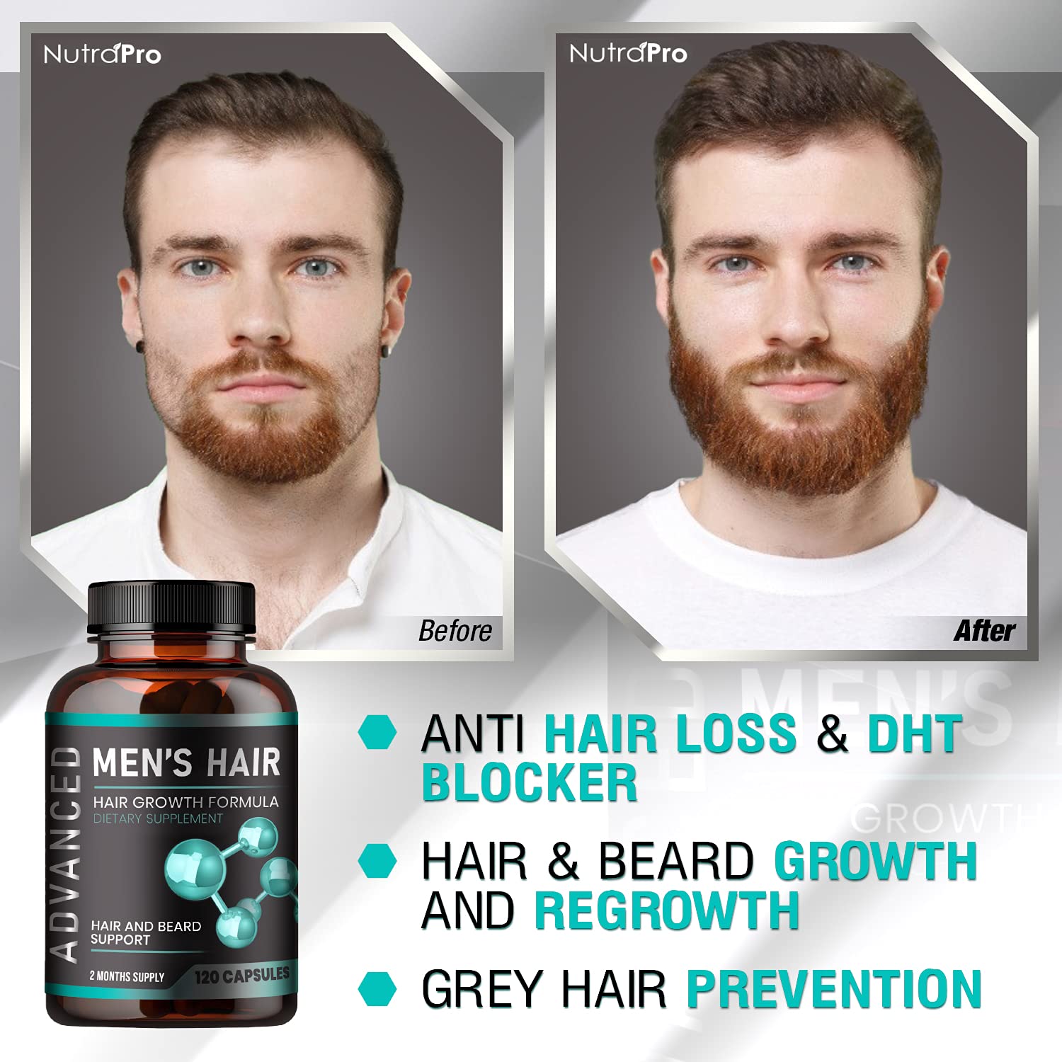 Mua Hair Growth Vitamins For Men - Anti Hair Loss Pills. Regrow Hair &  Beard Growth Supplement For Volumize, Thicker Hair.Stop Hair Loss And  Thinning Hair With Biotin & Saw Palmetto Hair
