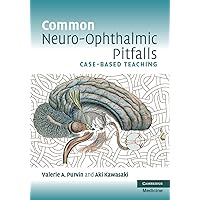 Common Neuro-Ophthalmic Pitfalls: Case-Based Teaching (Cambridge Medicine (Paperback)) Common Neuro-Ophthalmic Pitfalls: Case-Based Teaching (Cambridge Medicine (Paperback)) Paperback Kindle Printed Access Code