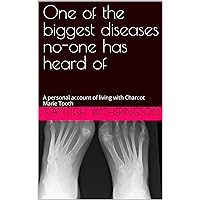 One of the biggest diseases no-one has heard of: A personal account of living with Charcot Marie Tooth
