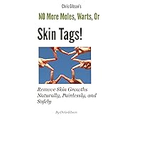 No More Moles Warts or Skin Tags! No More Moles Warts or Skin Tags! Kindle