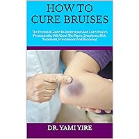 HOW TO CURE BRUISES : The Essential Guide To Understand And Cure Bruises Permanently, (All About The Types, Symptoms, Risk, Treatment, Preventions And Recovery) HOW TO CURE BRUISES : The Essential Guide To Understand And Cure Bruises Permanently, (All About The Types, Symptoms, Risk, Treatment, Preventions And Recovery) Kindle Paperback